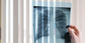 RöntgenbilderundKnochengesundheit